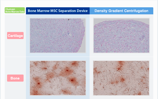 [Illustrated] Comparison with conventional methods