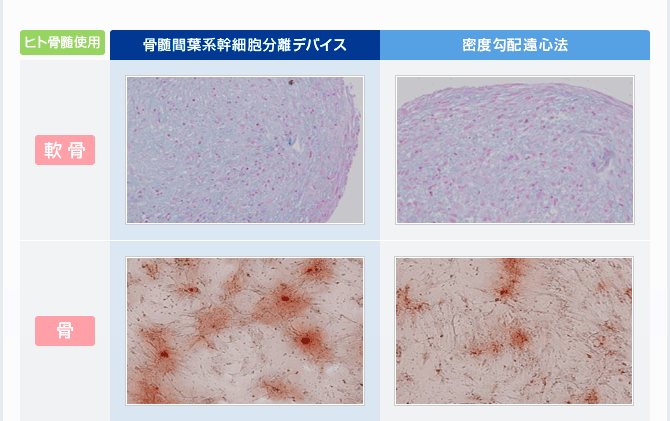 【図解】密度勾配遠心法との比較