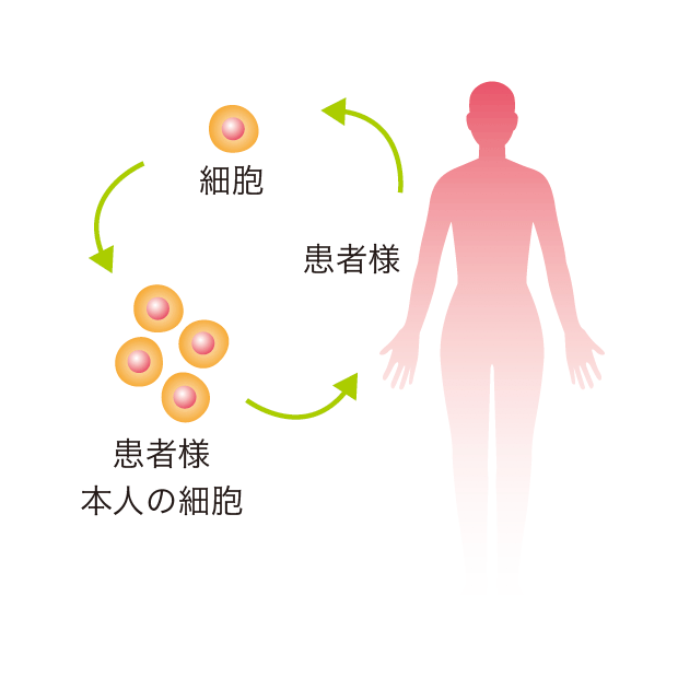 自家細胞移植イメージ