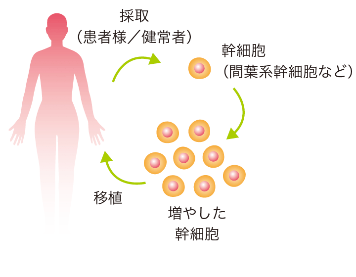 幹細胞のまま移植イメージ