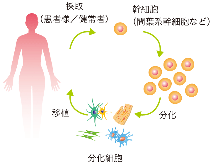 幹細胞を分化させてから移植イメージ