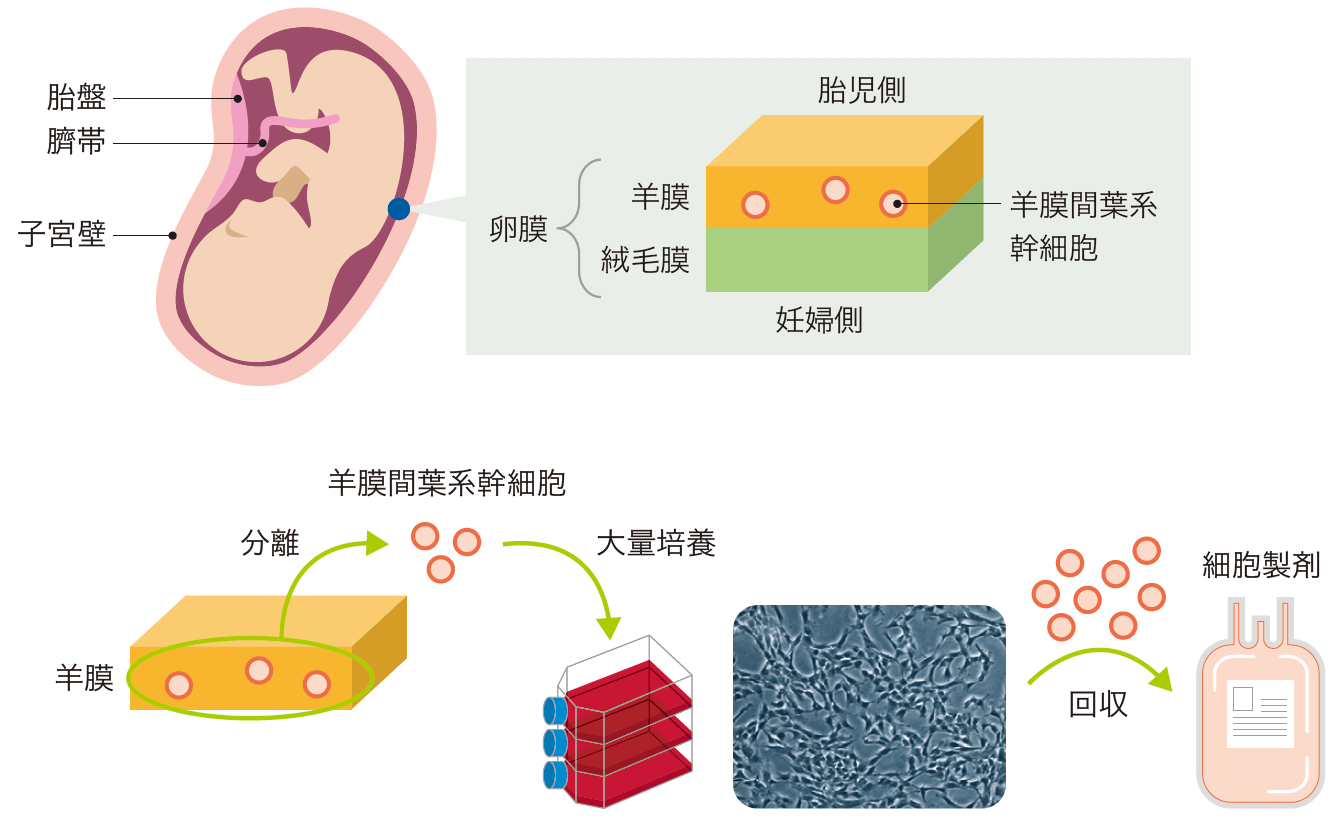 間 葉 系 幹細胞