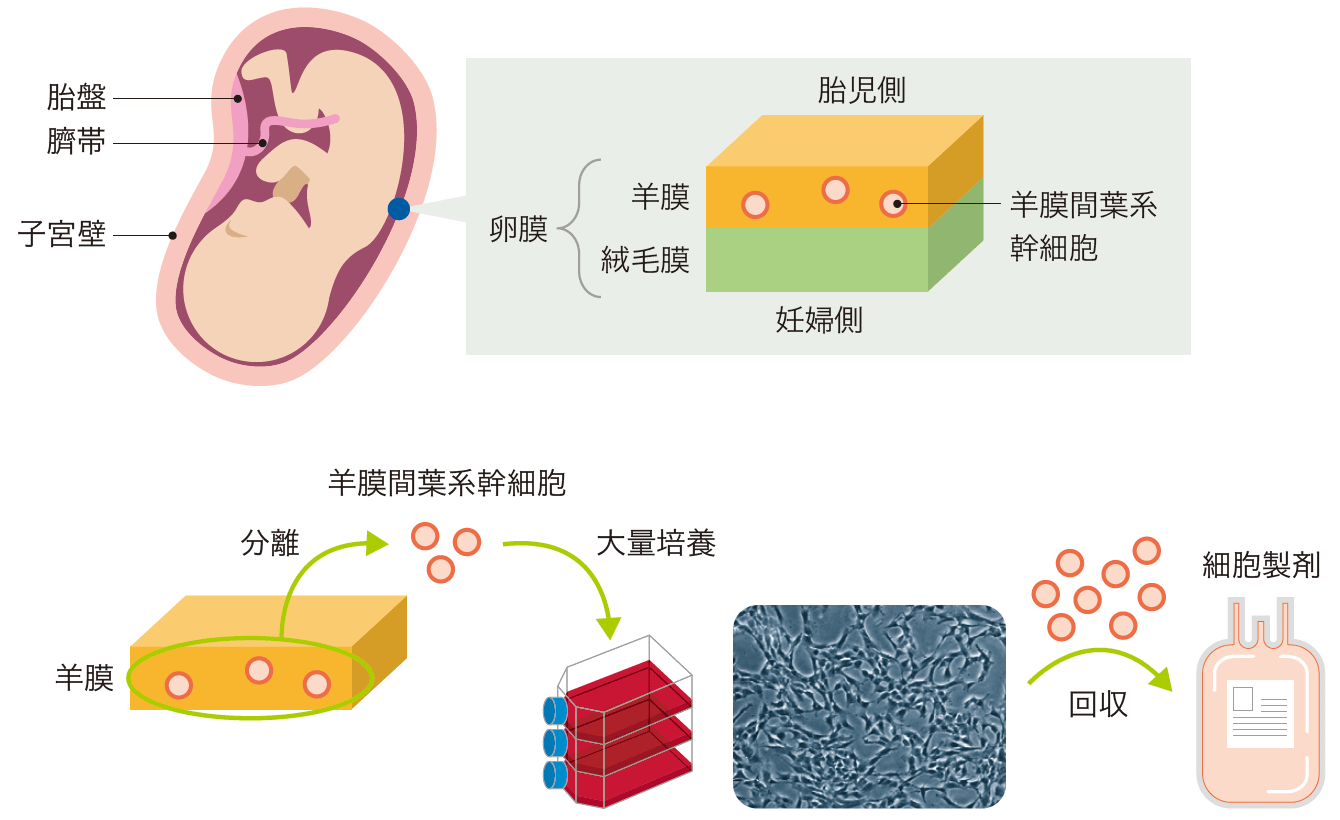 羊膜間葉系幹細胞製剤の開発のプロセスイメージ図